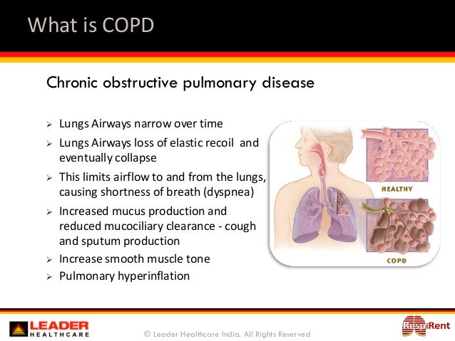 essay on chronic obstructive pulmonary disease Chronic obstructive pulmonary disease health and medicine essay undergraduate level. essay on chronic obstructive pulmonary disease Chronic obstructive pulmonary disease health and medicine essay undergraduate level.